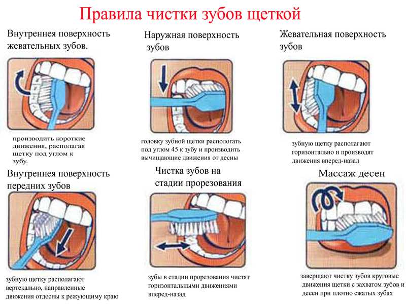 Как правильно чистить зубы